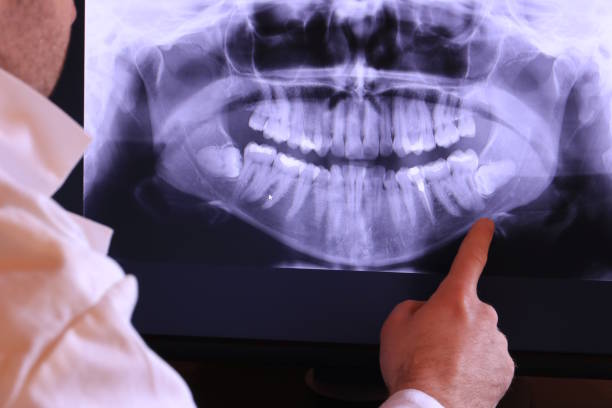 Best Emergency Treatment for Oral Infections in Lakemoor, IL